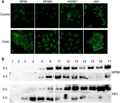 Mechanisms of Anergic Inflammatory Response in Nasopharyngeal Carcinoma Cells Despite Ubiquitous Constitutive NF-κB Activation